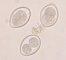 顕微鏡で見たコクシジウム原虫