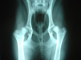 股関節形成不全のレントゲン写真